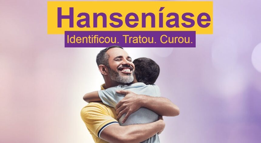 Hanseníase, Combate e Prevenção